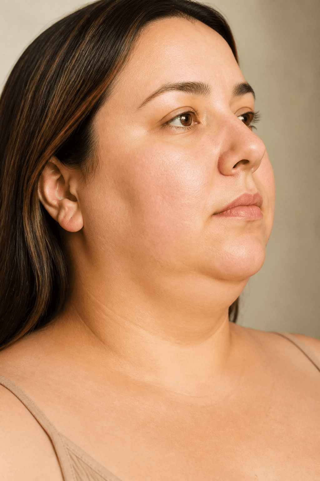 Double Chin at Ensoul Aesthetics Calgary