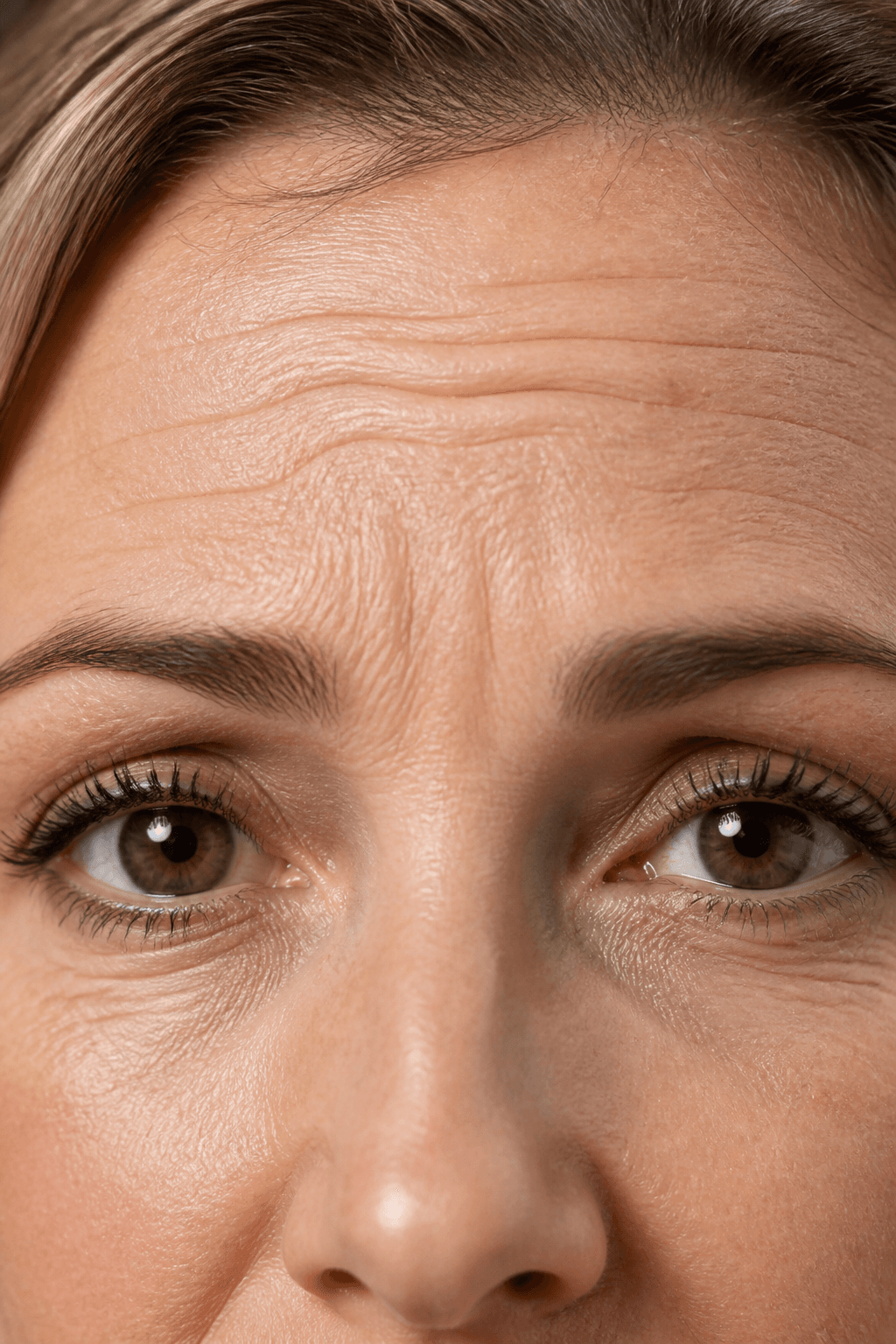Wrinkled Skin at Ensoul Aesthetics Calgary
