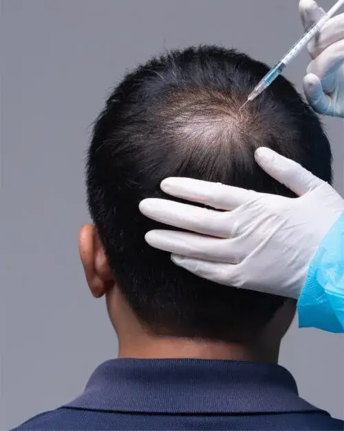 Hair Restoration