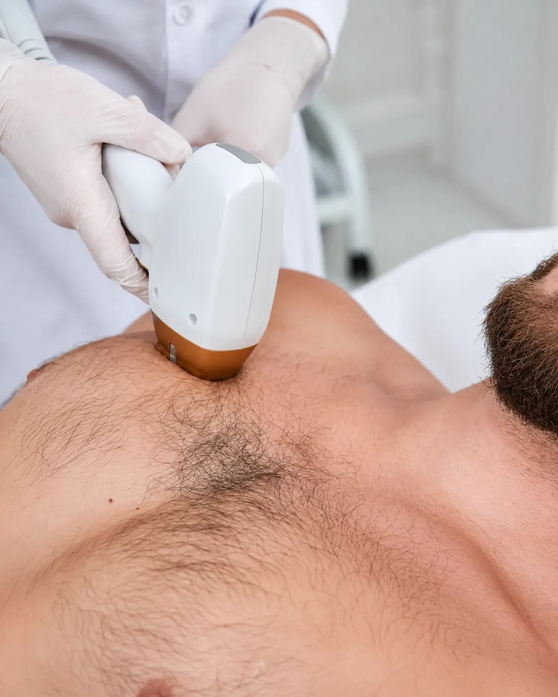 Laser Hair Removal