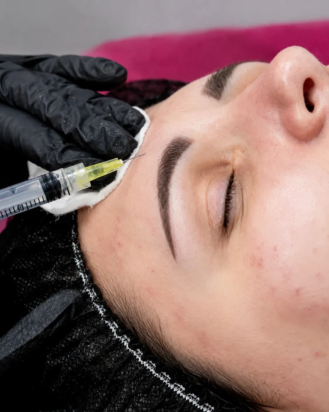 Mesotherapy