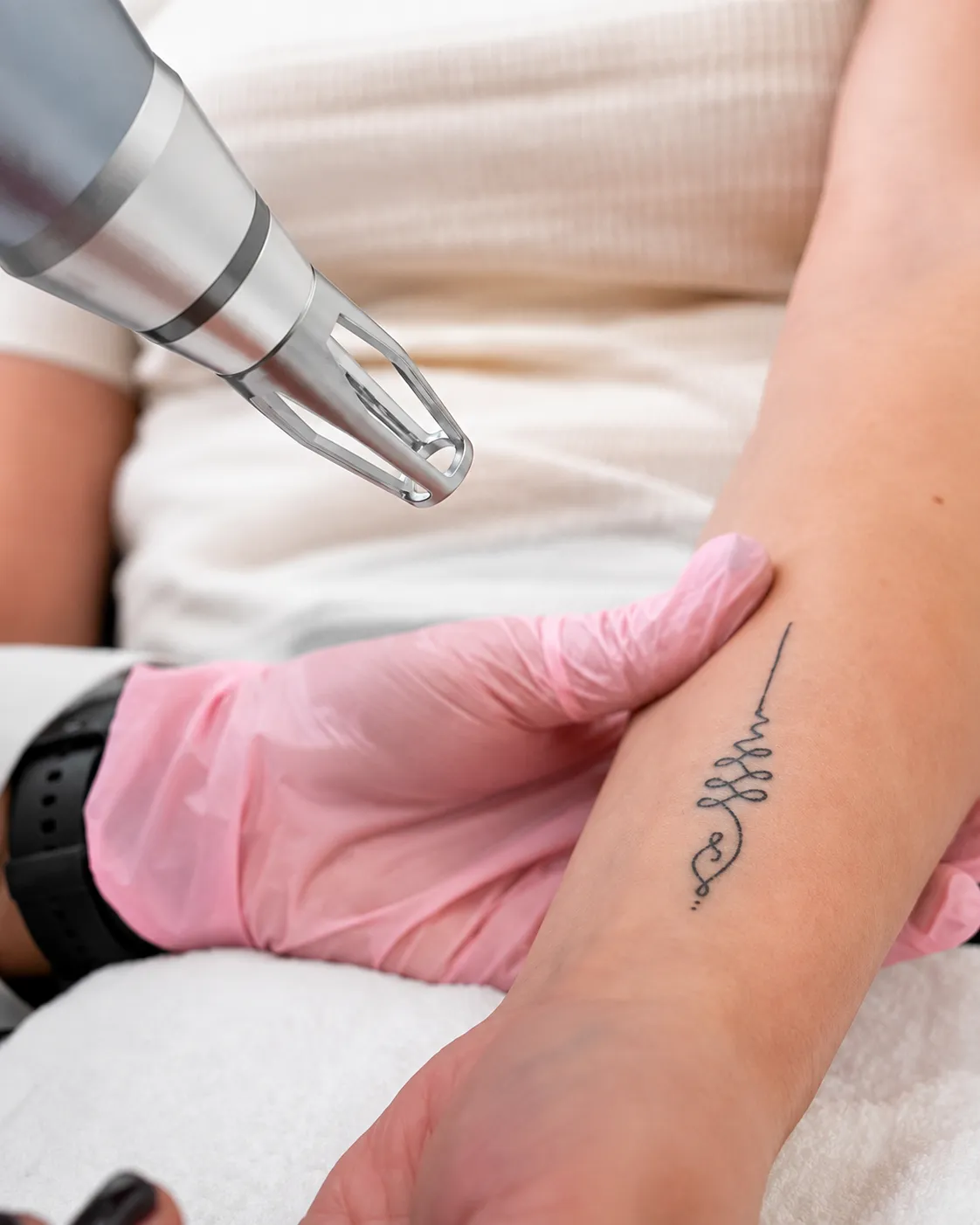 PicoSure Tattoo Removal