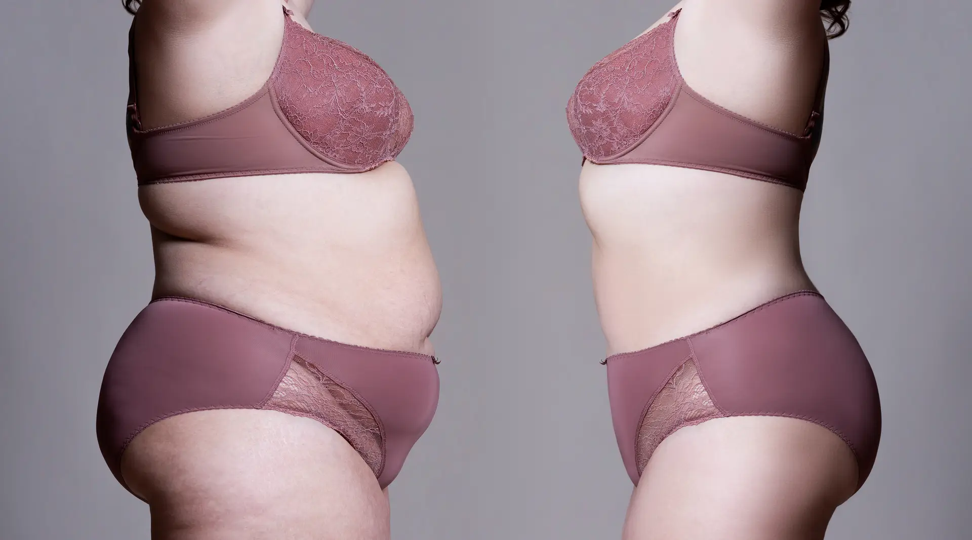 Combining Fillers and HIFEM: The Calgary Guide to Full Body Sculpting