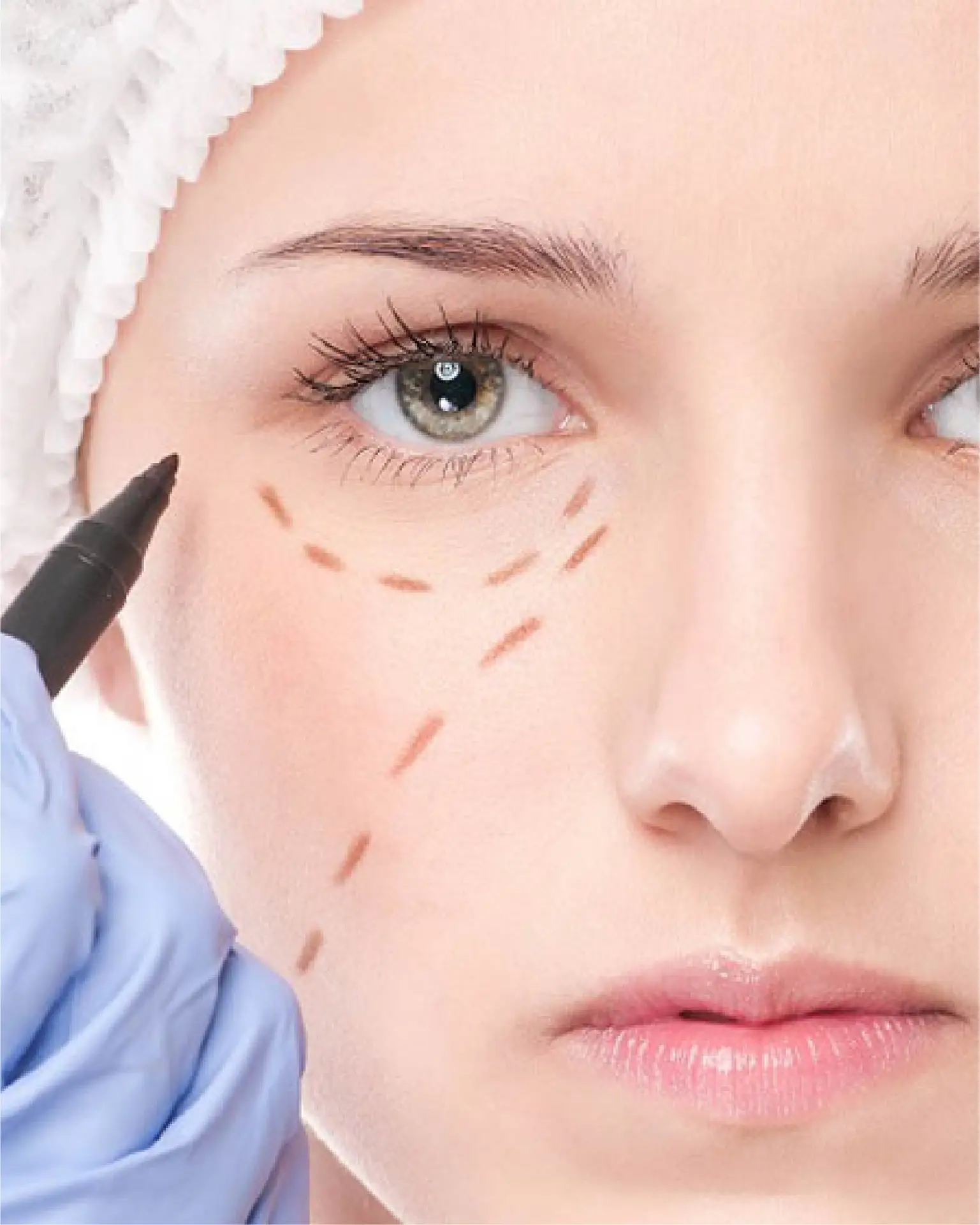 Under-Eye Bag Dark Circle Treatment