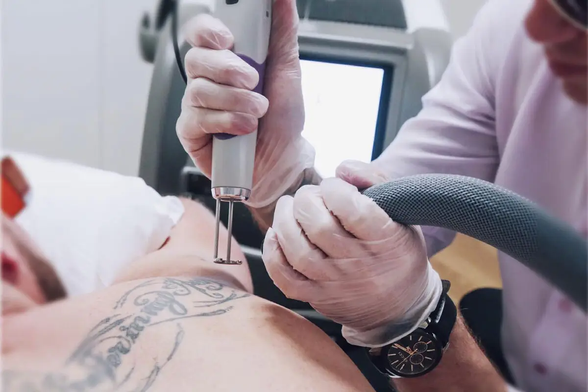 How Does Tattoo Removal Works?