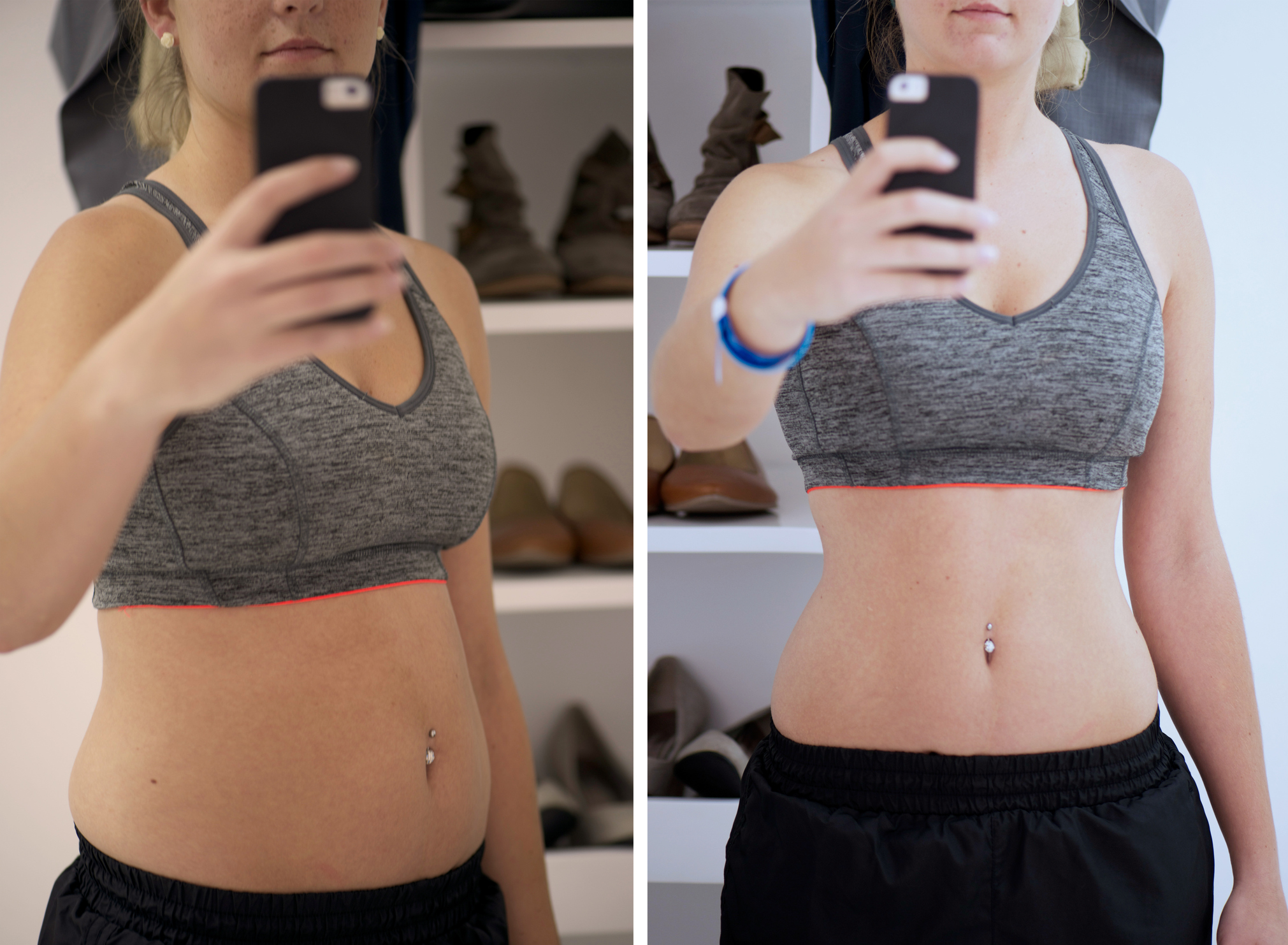 Before and after selfies of a young woman tracking her progress