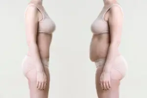 Woman's body before and after weight loss